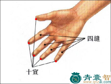 十宣穴的主治功效位置图解-青囊智