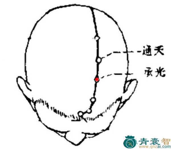 承光穴的主治功效位置图解-青囊智