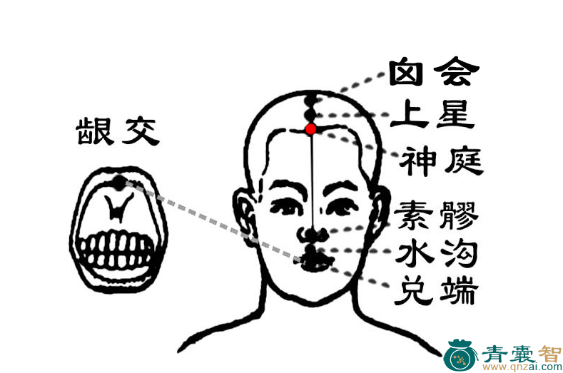 神庭穴的主治功效位置图解-青囊智