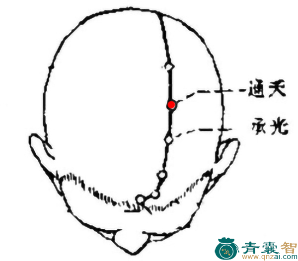 通天穴的主治功效位置图解-青囊智