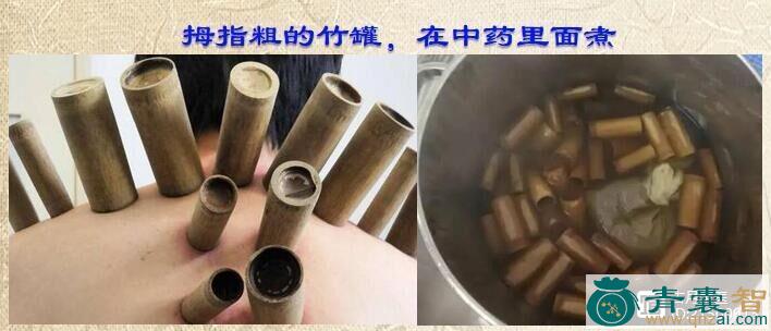 酸罐罐的性味归经以及功效用法和注意事项-青囊智